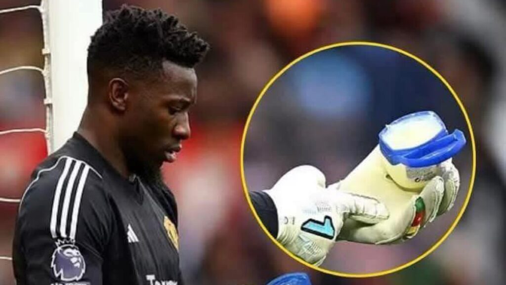 Penggunaan 'Zat Asing' Tidak Bisa Menyelamatkan Andre Onana di Laga Lyon vs Manchester United